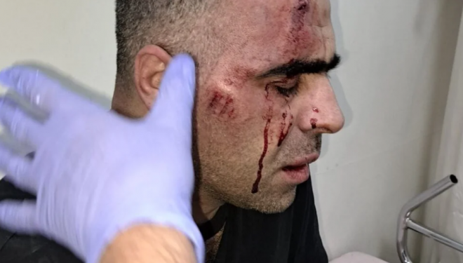 Gazeteci Sinan Aygül’e saldırı