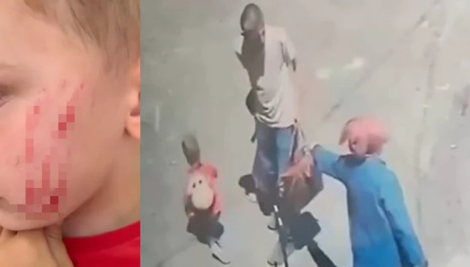 Van’da sokakta oynayan çocuğa saldırı!