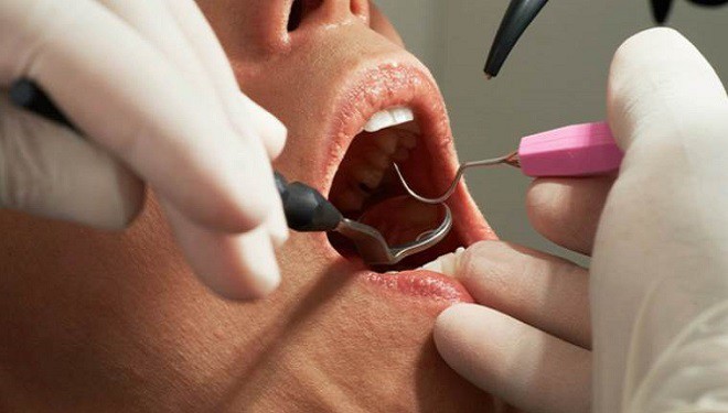 Özel klinikte 4 dişini çeken kişi 'temizlik görevlisi' çıktı