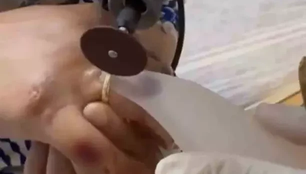 Kazada yaralanan kadının parmağına sıkışan