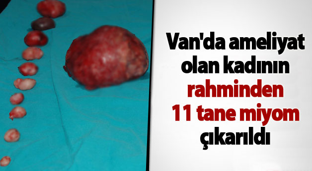 Van'da ameliyat olan kadının rahminden 11 tane miyom çıkarıldı